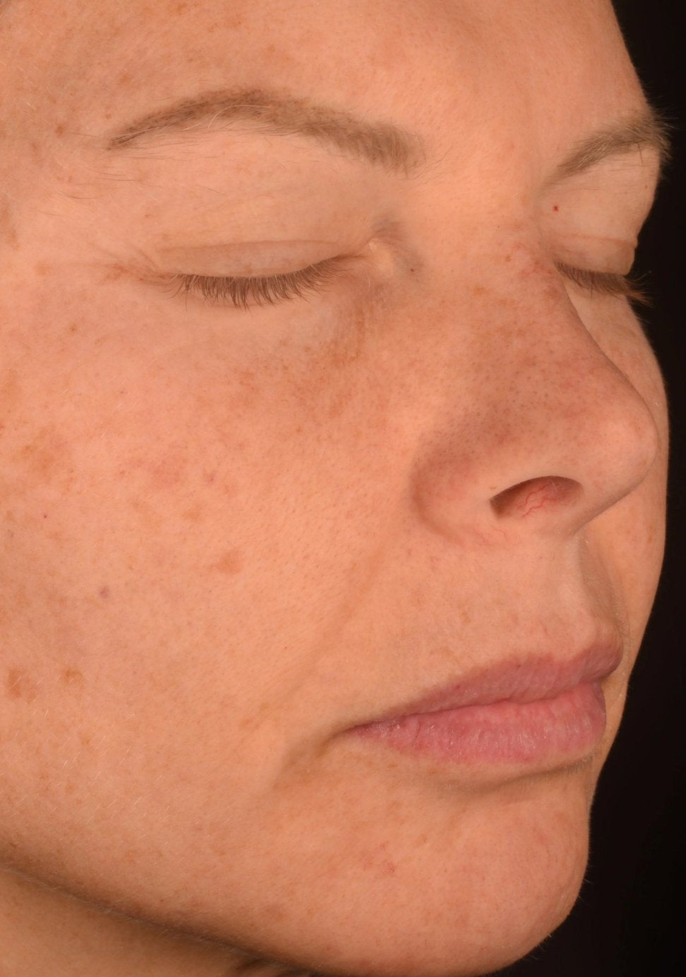 Participant 1 after 8 weeks