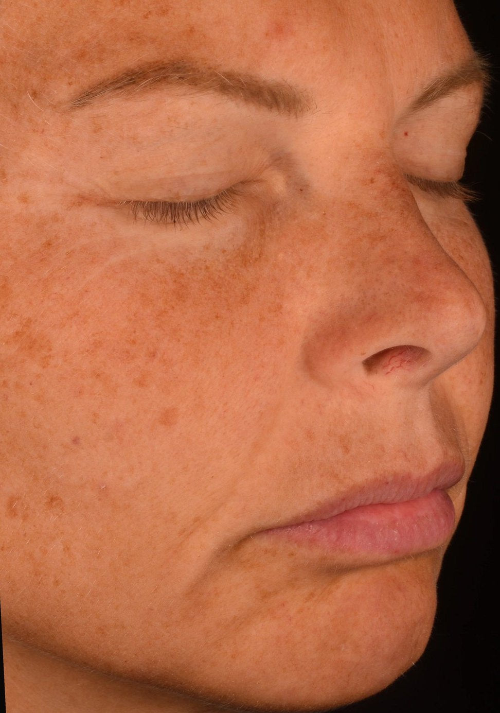 Participant 1 before use
